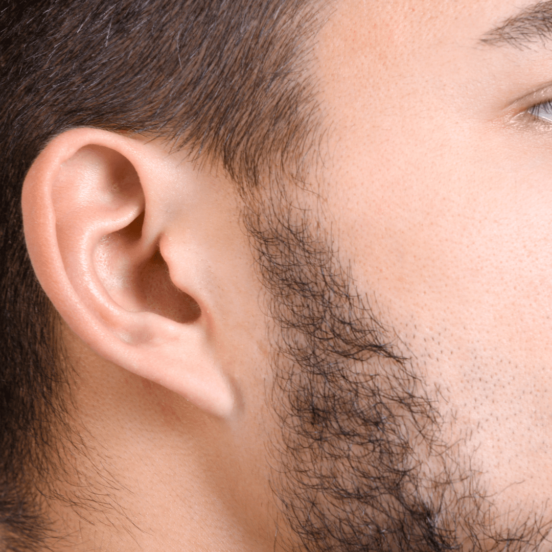 Facial Hair Transplant (hair) Glojas Aesthetic