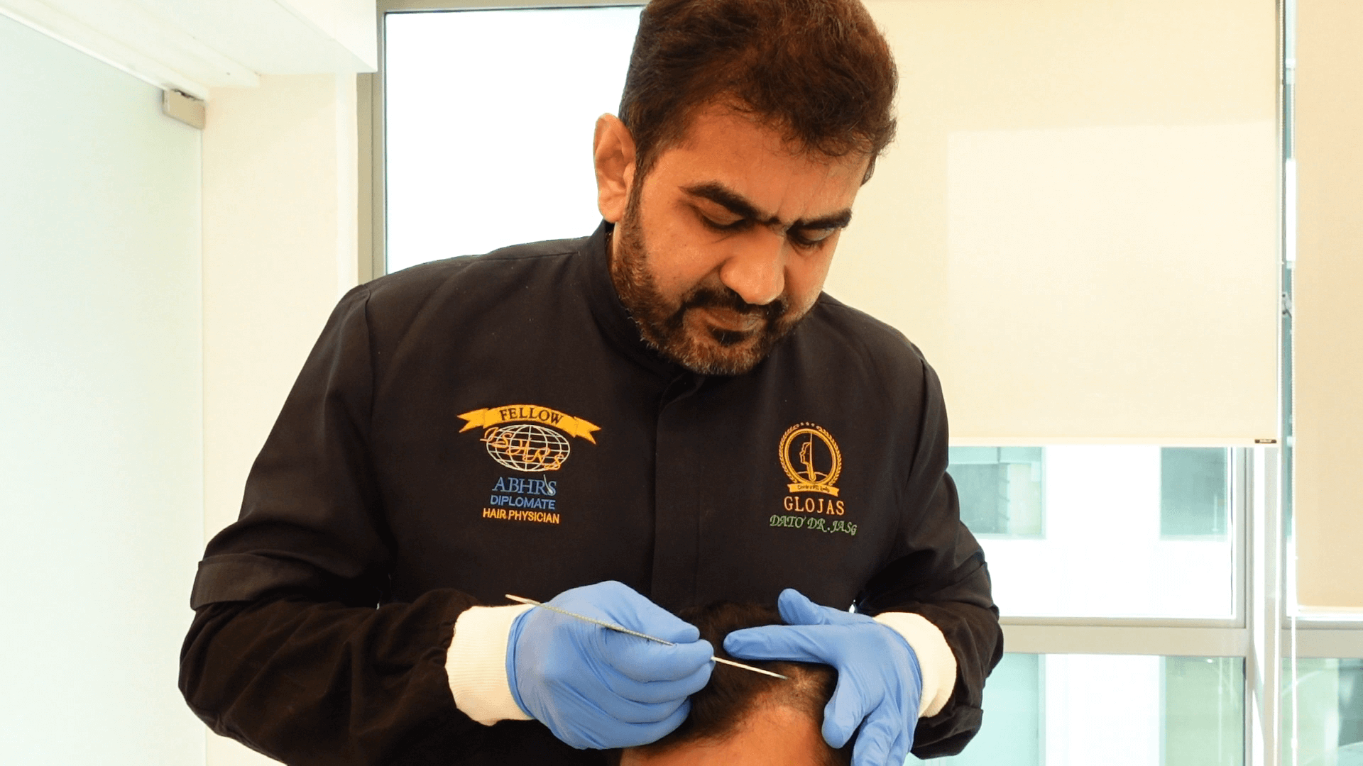 Choosing the right donor area for hair transplant