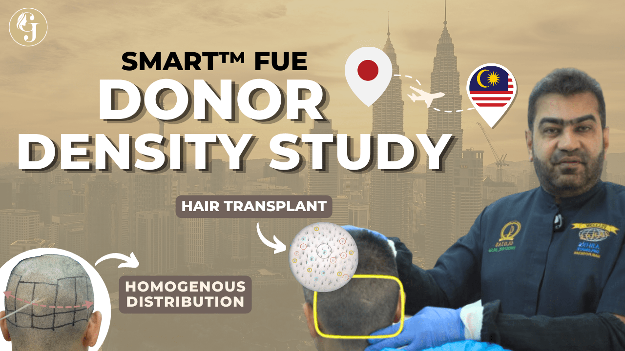 Donor Density Study (Part-1) | SMART™ FUE Hair Transplant