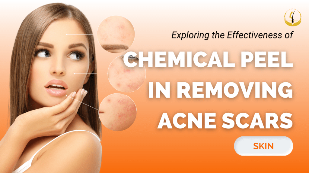 Curated visual reference: Chemical Peel In Removing Acne Scars Photo Inspiration