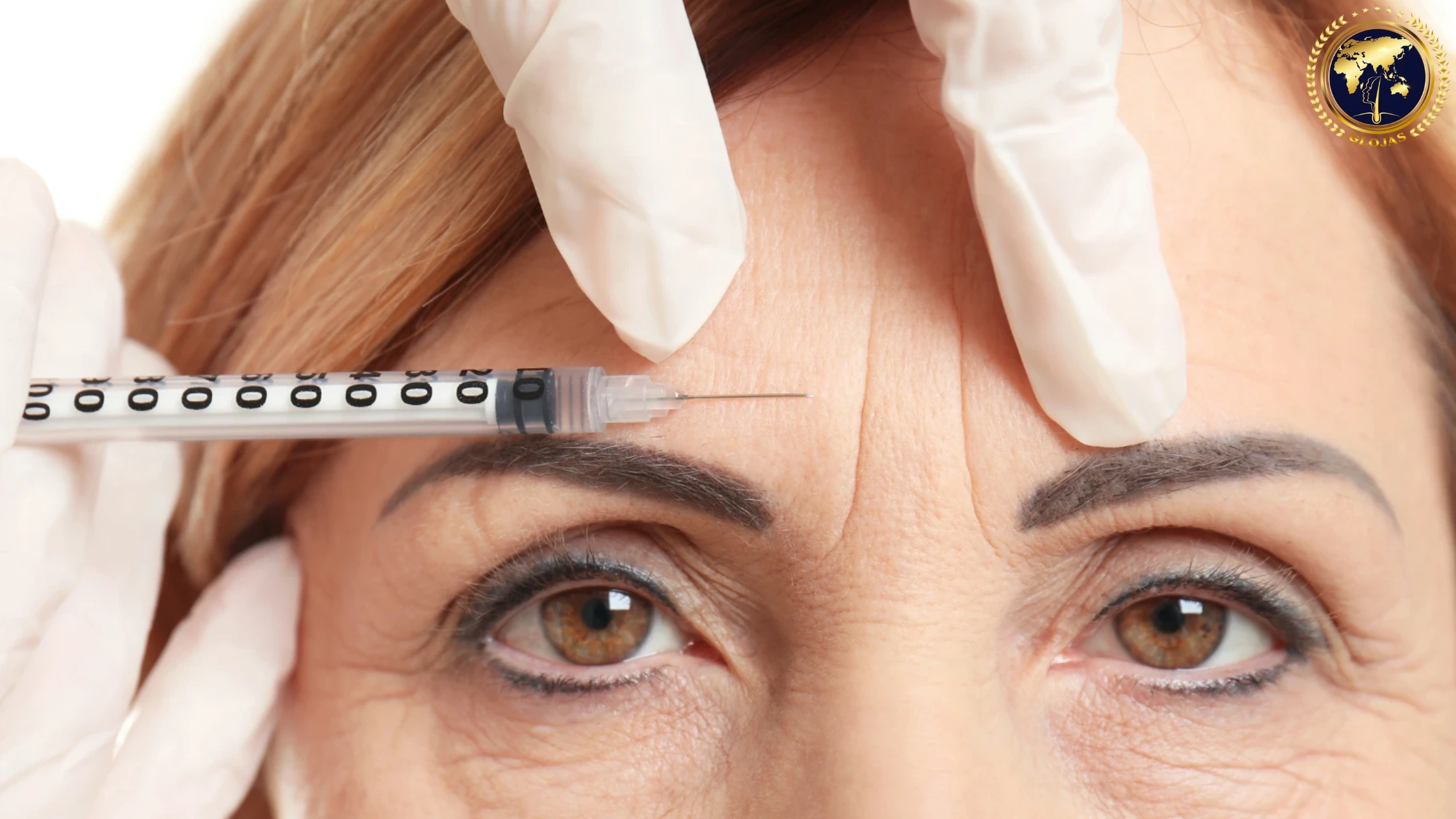 Botox Injections Near Me